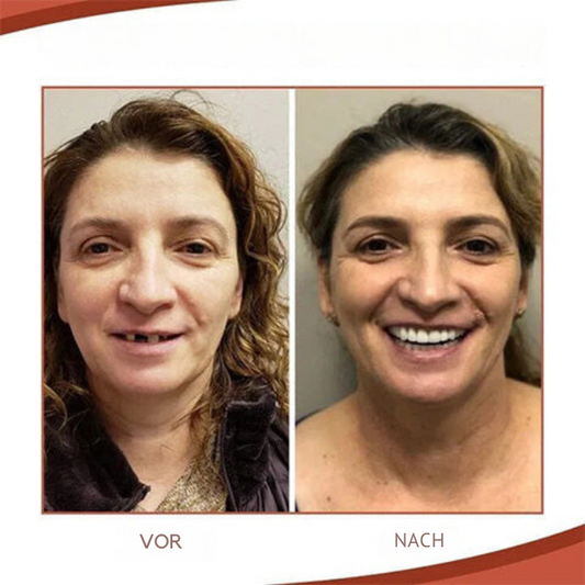 Davy | Biocompatible Silicone Prosthesis Set for Pain-Free Fit and Natural Smile