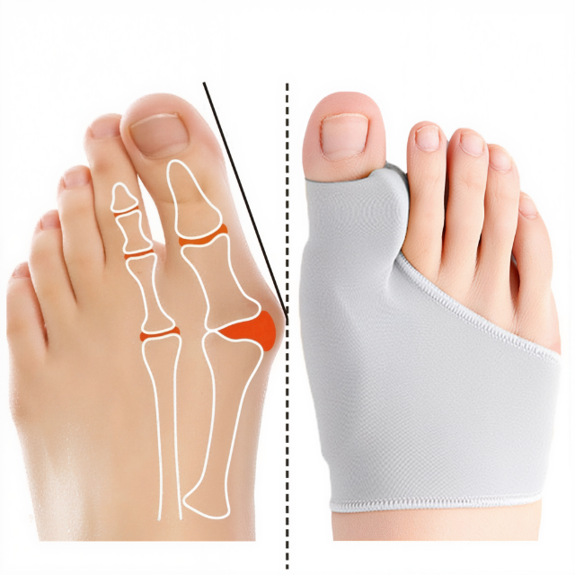 Davy | Bunion Corrector Gel Pad for Foot Pain Relief