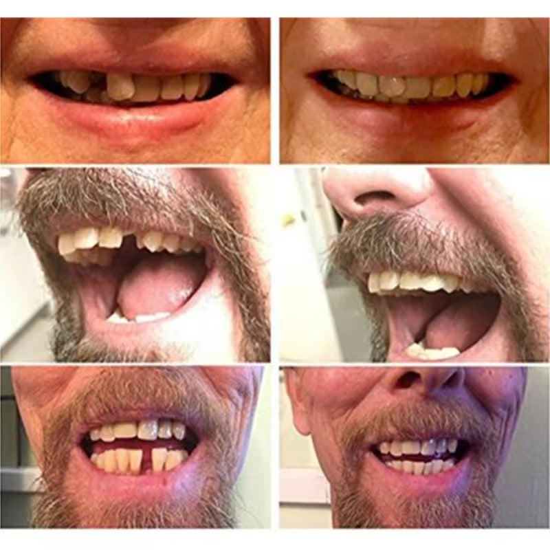 Davy | High-Quality False Teeth