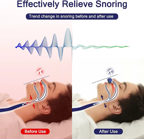 Davy | Micro CPAP sleep apnea machine for travel and anti-snoring - CPAP alternative