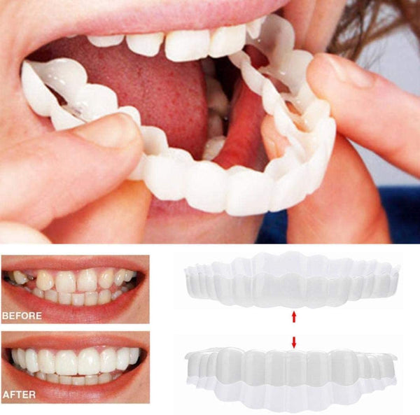 Davy | On Smile Veneers (Upper and Lower Jaw Included)