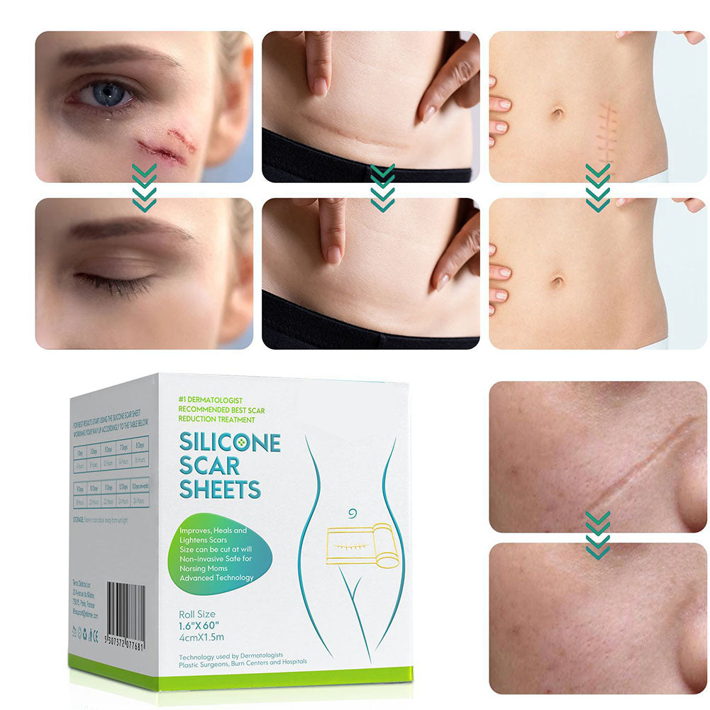 Davy | Silicone Scar Tape Roll
