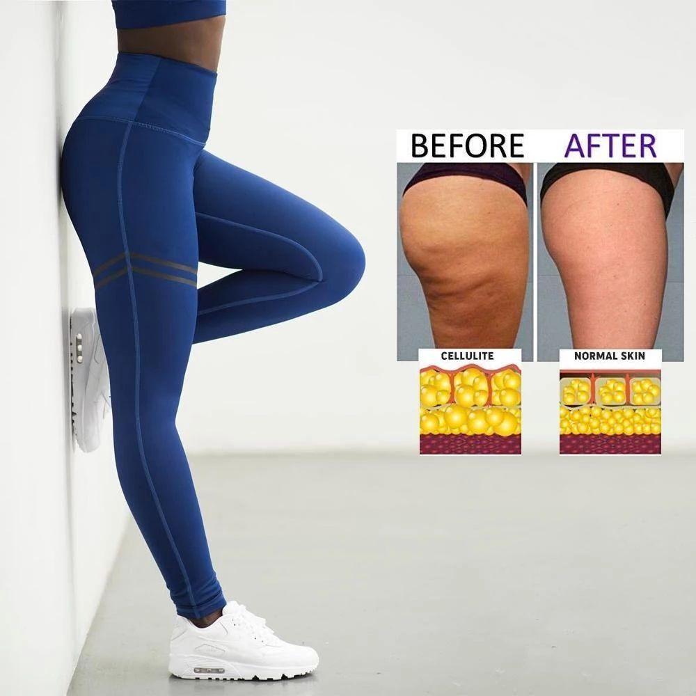Davy | Women's Anti-cellulite Compression Leggings