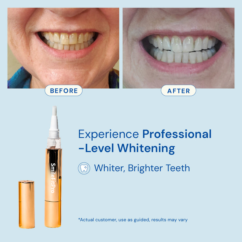 GleamRush™ Serum — Ignite Unstoppable Confidence with a Brilliant, Stain-Free Smile