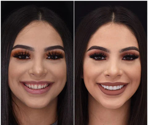 LumaGrin Instant Snap-On Veneers For Upper and Lower Teeth