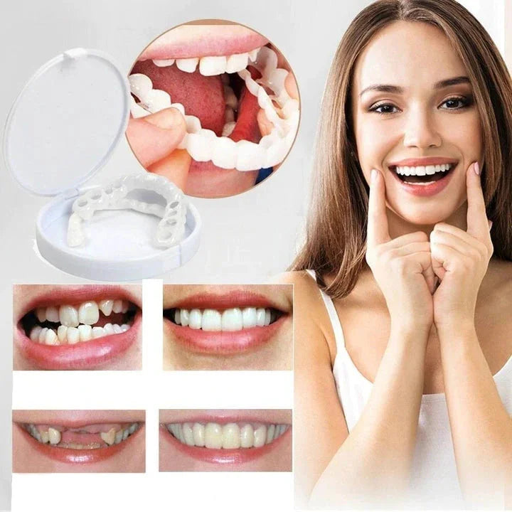LumaGrin Instant Snap-On Veneers For Upper and Lower Teeth