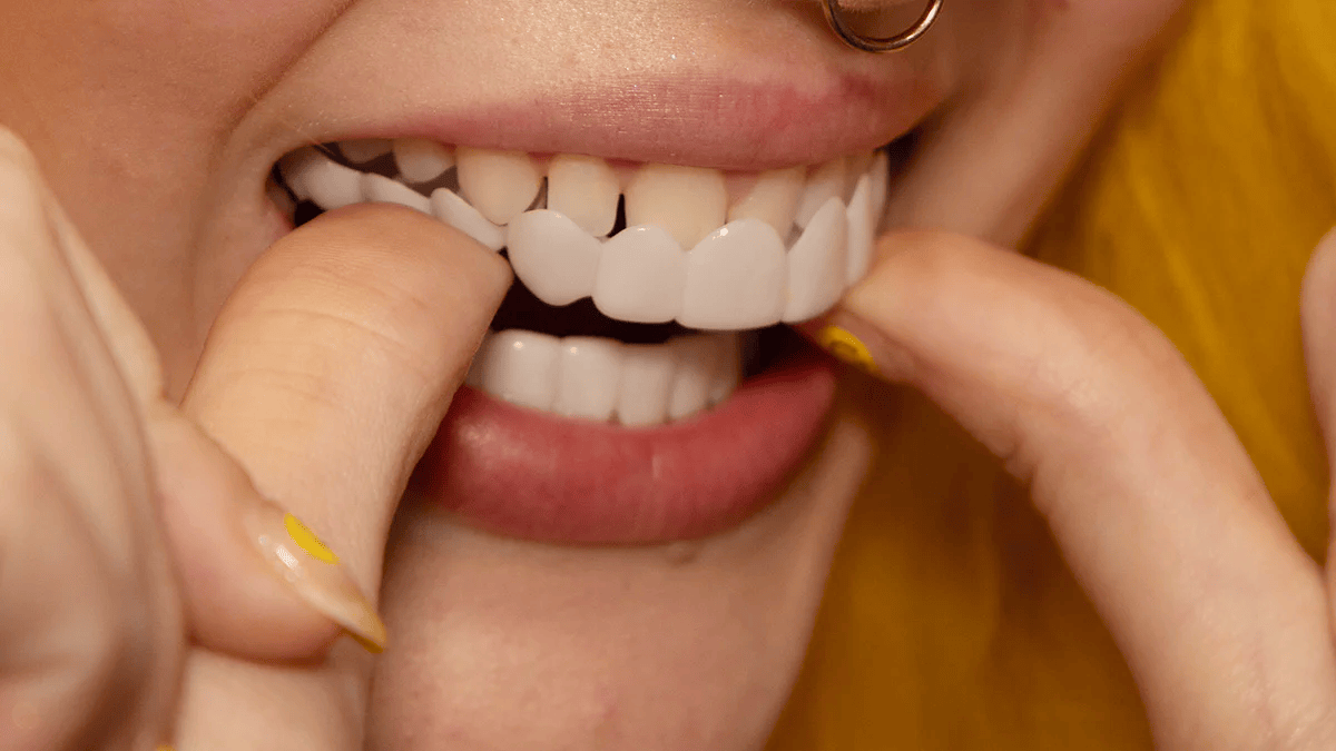 NovaBright Snap On Veneers For Upper And Lower Teeth Instant Natural Smile