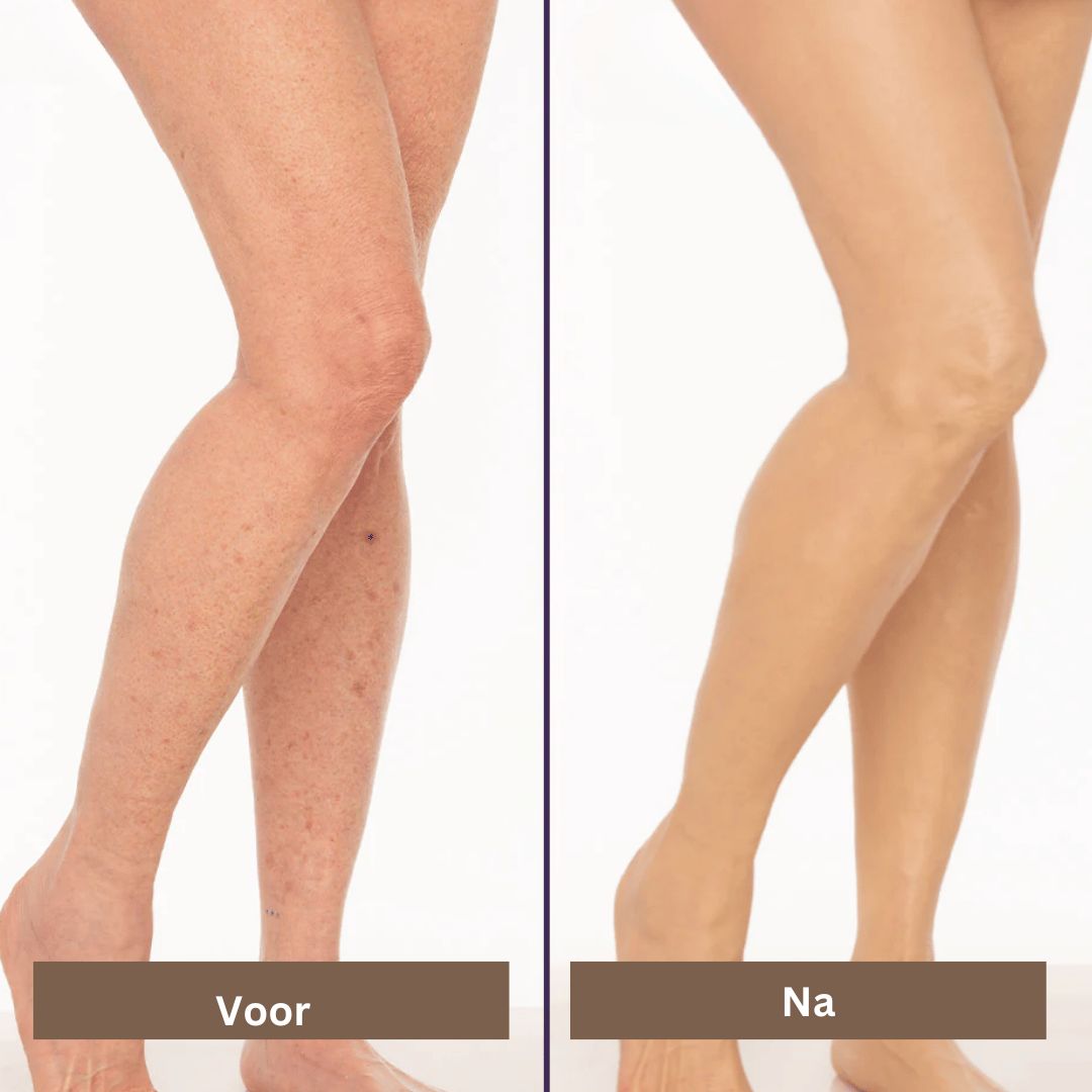 Waterproof Concealer | Covers blemishes, scars, and tattoos - long-lasting